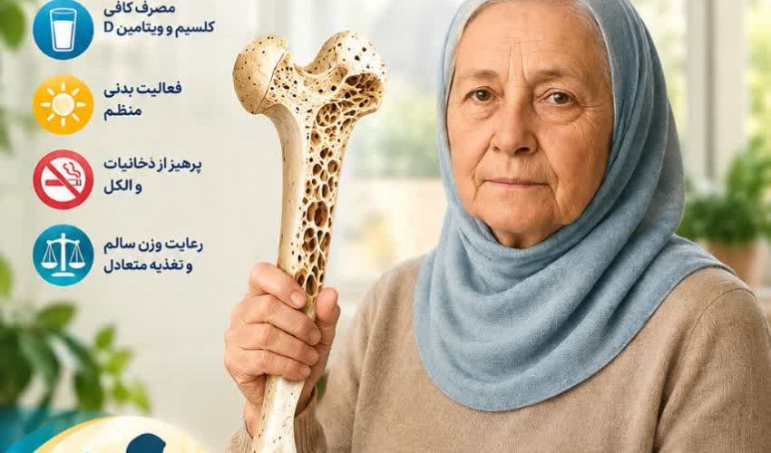 پوکی استخوان را جدی بگیریم