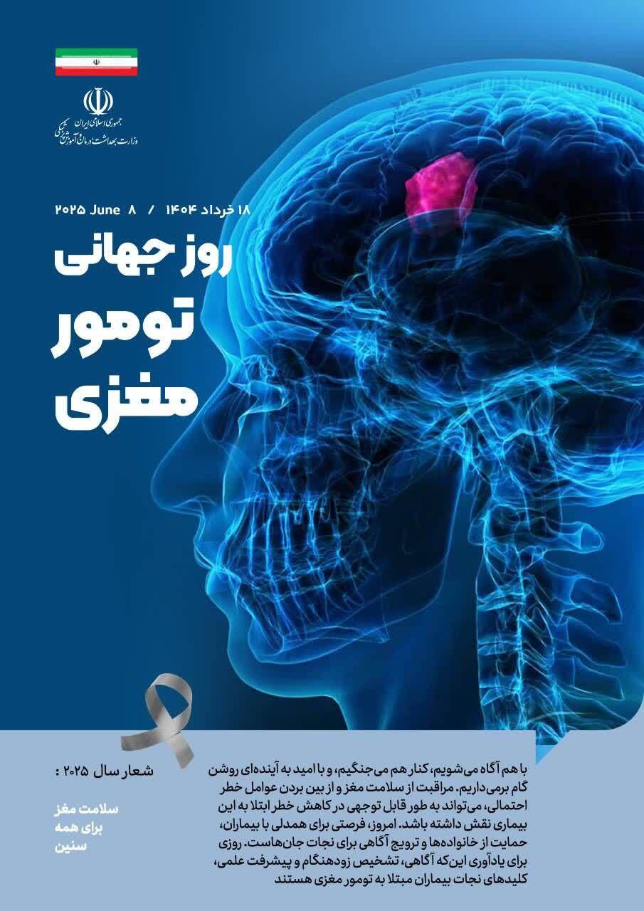 ۱۸ خردادماه؛ روز جهانی تومور مغزی