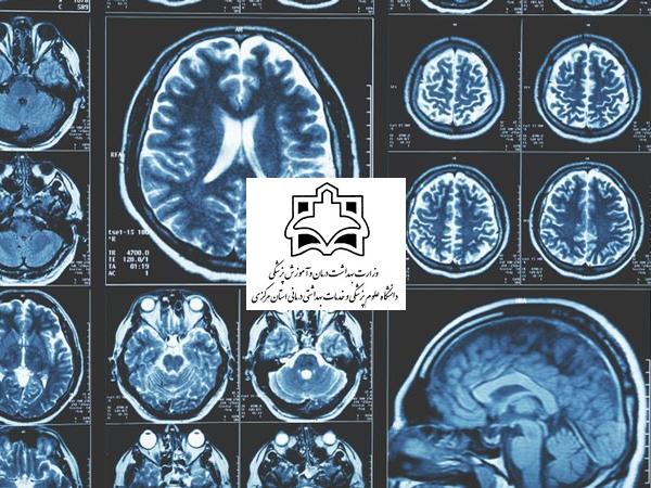 پردازش و آنالیز تصاویر پزشکی، گامی در جهت کیفیت تشخیص