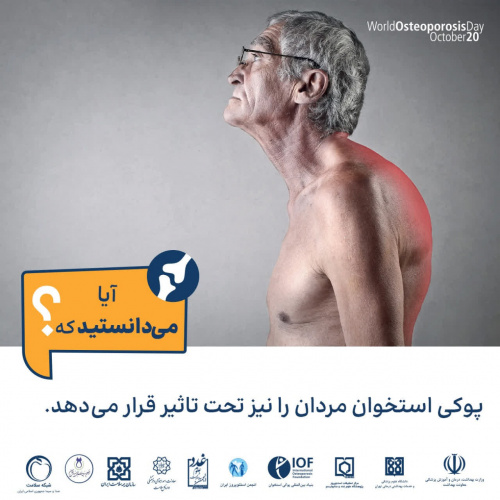 پوکی استخوان مردان را نیز تحت تأثیر قرار می دهد.