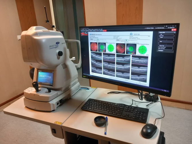 معرفی دستگاه OCT-Triton Plus