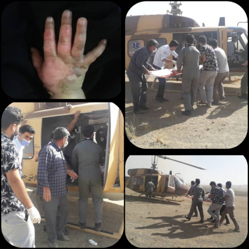 انتقال بیمار سوختگی توسط بالگرد اورژانس هوایی استان مرکزی