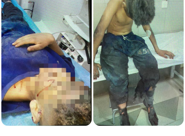 مصدوم شدن ۲ نفر بر اثر انفجار مواد محترقه