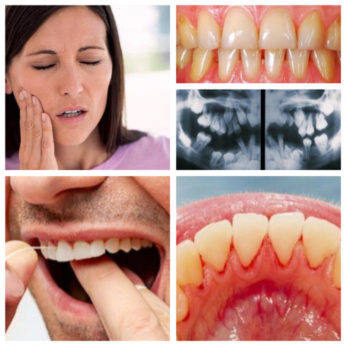 ۱۳مشکلی که ممکن است برای دندان‌ها اتفاق بیفتد