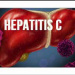 دستورالعمل راهنمای بالینی بومی درمان هپاتیت C مزمن