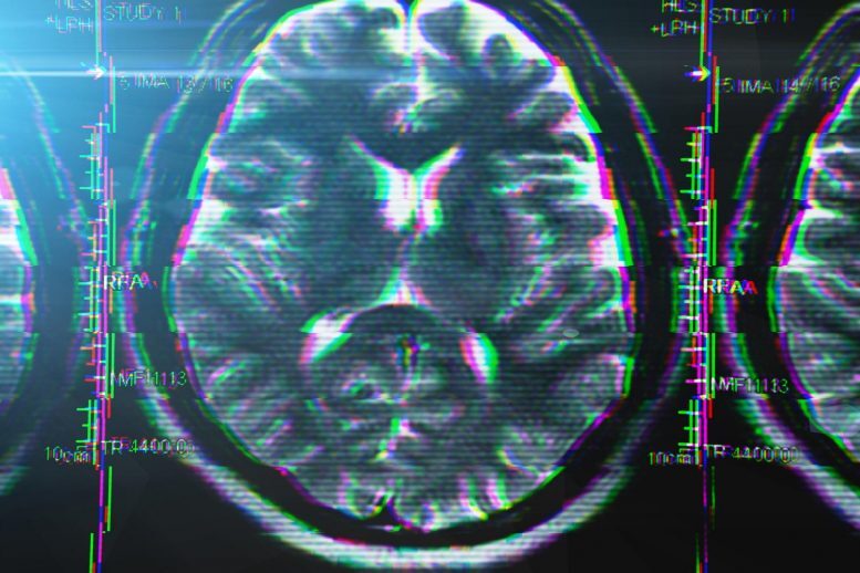 Coronavirus Does Not Infect the Brain, but Still Inflicts Significant Neurological Damage
