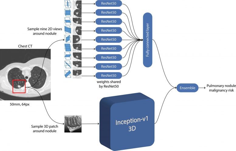 Artificial Intelligence Program Accurately Predicts Lung Cancer Risk