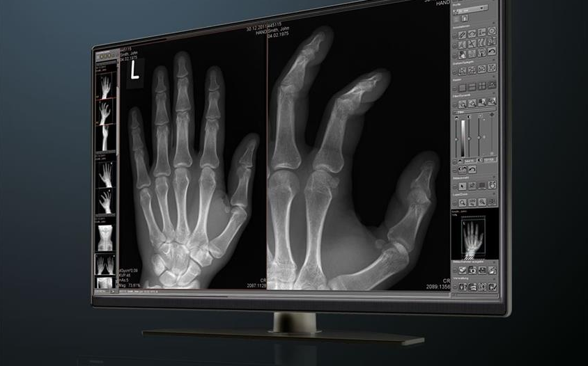For Hospitals, Radiology Optimization First Requires the Right IT Foundation