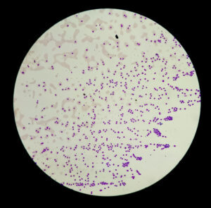 Eliminating Cancer Cells by Changing Their Identity