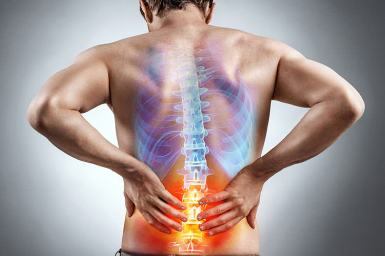 علت های شایع کمردرد