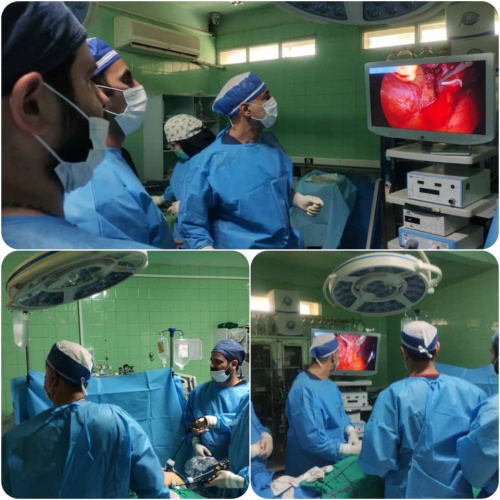 انجام عمل جراحی آپاندکتومی لاپارسکوپی در مرکز آموزشی درمانی حضرت ولیعصر (عج )