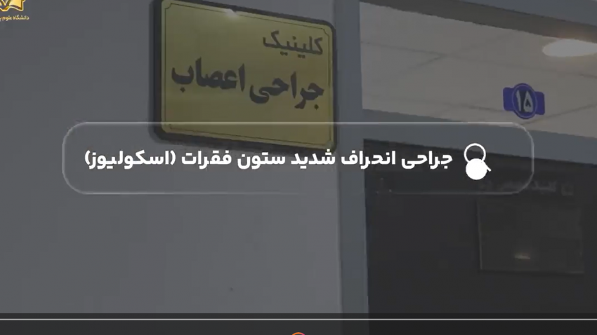انجام موفقیت‌آمیز جراحی پیچیده اصلاح انحنای شدید ستون فقرات در بیمارستان ولی‌عصر(عج) اراک