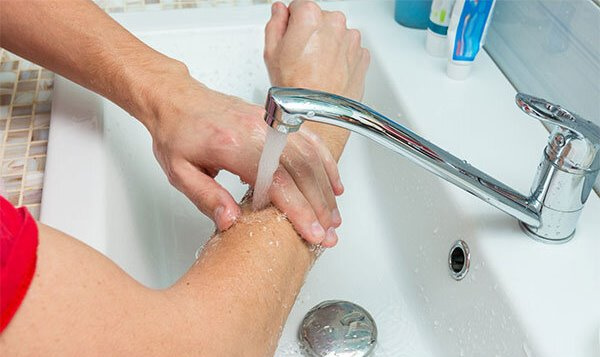 چگونه سوختگی دست را درمان کنیم؟