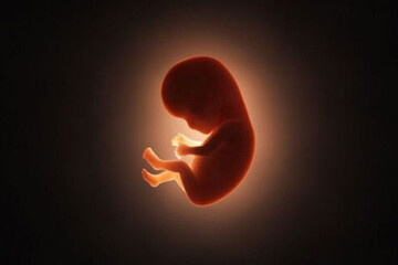 فهرست دارو و تجهیزات که مصداق فراهم سازی وسایل سقط عمدی جنین است
