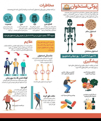 در خصوص پوکی استخوان بیشتر بدانید...