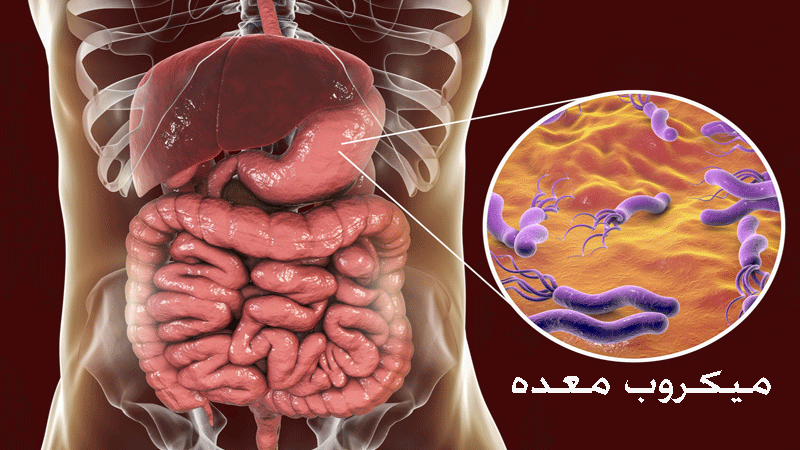 میکروب معده یا هلیکوباکترپیلوری
