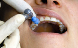 انجام خدمات سطح یک دندانپزشکی در پایگاه های سلامت و خانه های بهداشت