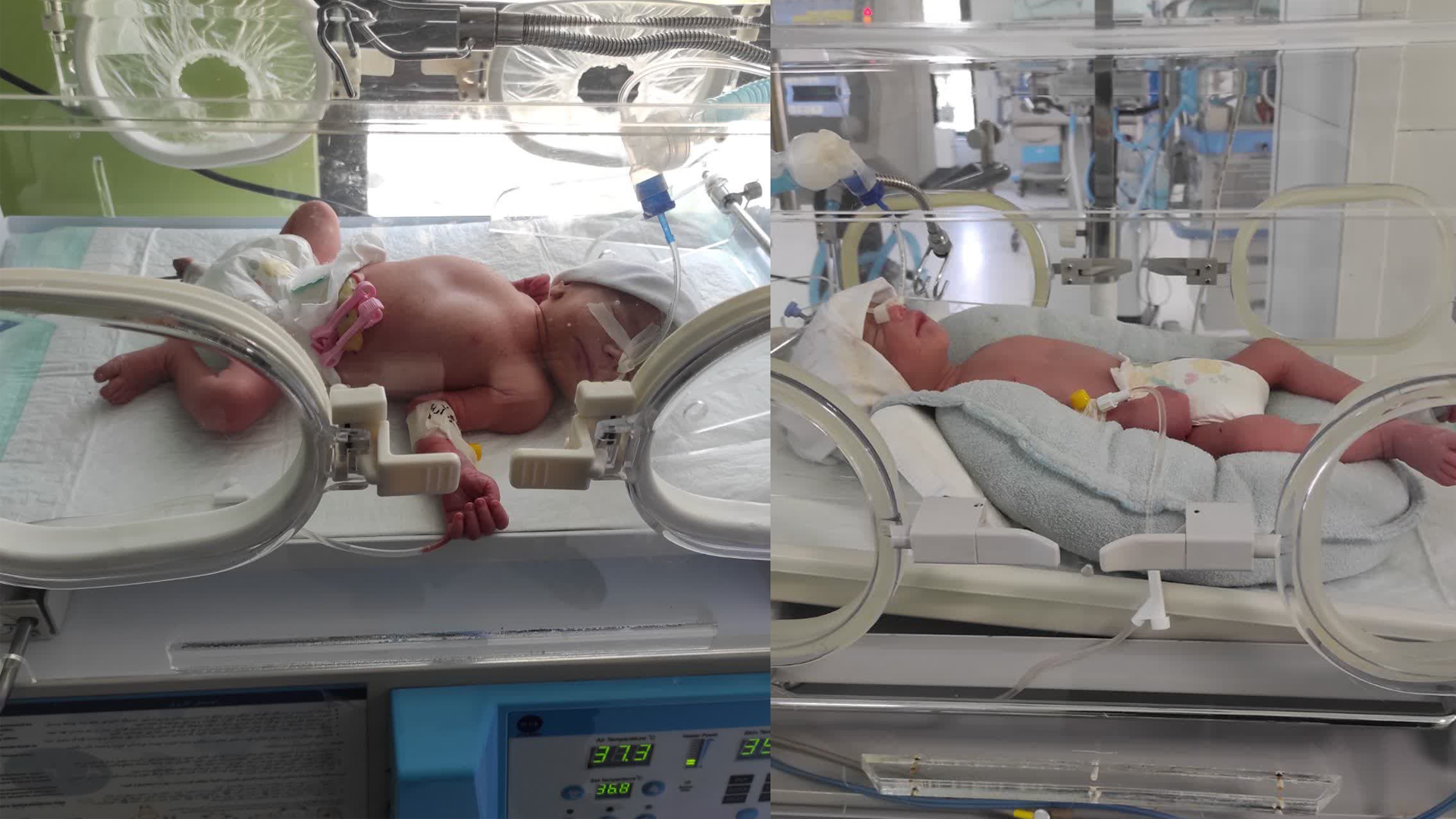تولد نخستین نوزادان دو قلو در بیمارستان فوق تخصصی سینا رضایی آشتیانی